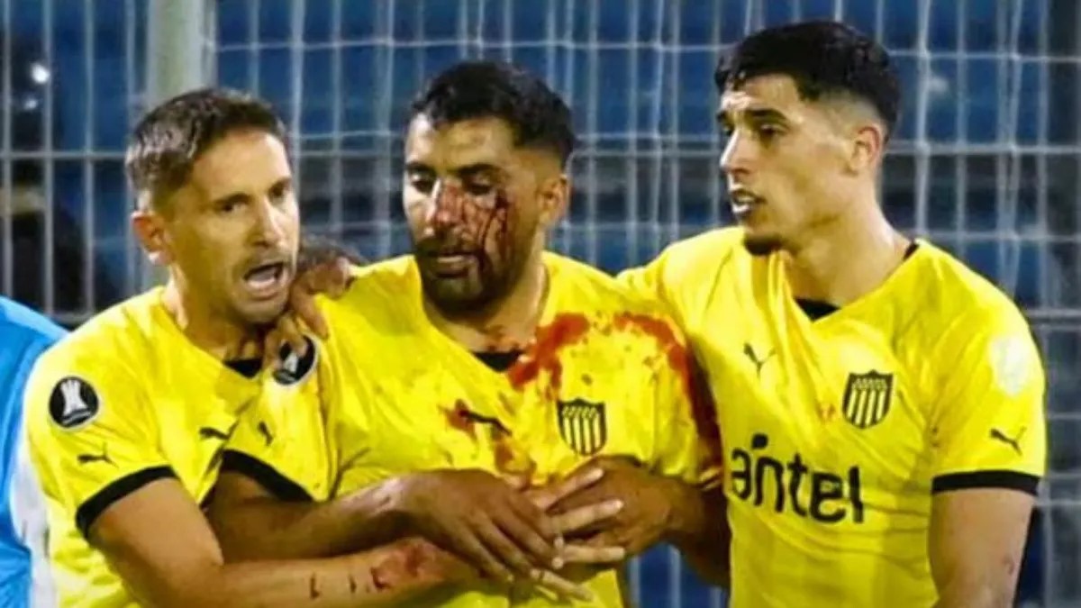 Violencia mancha victoria de Rosario Central sobre Peñarol, en Copa